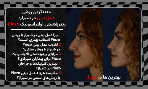 روش عمل بینی در شیراز: رینوپلاستی اولتراسونیک Piezo